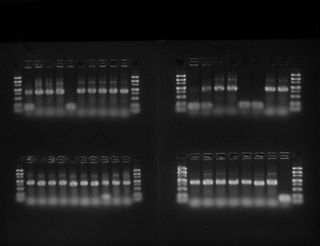 Electrophoresis Gel